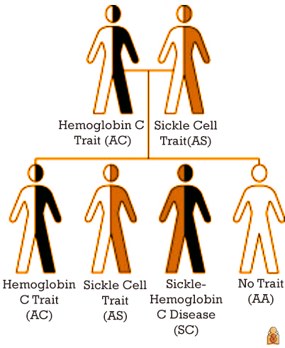 How is sickle cell disease inherited?