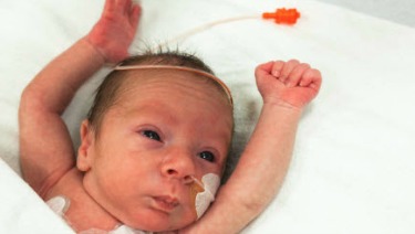 Corrected Age for Preemies