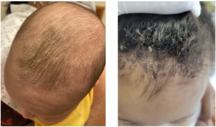 Know what it is and how to take care of Baby Hair