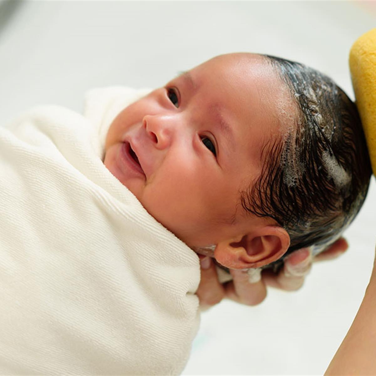 Qué es la costra láctea en el cuero cabelludo del recién nacido? 
