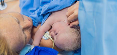 A newborn baby is cradled against a mother's chest in a hospital setting, surrounded by medical drapes and equipment.