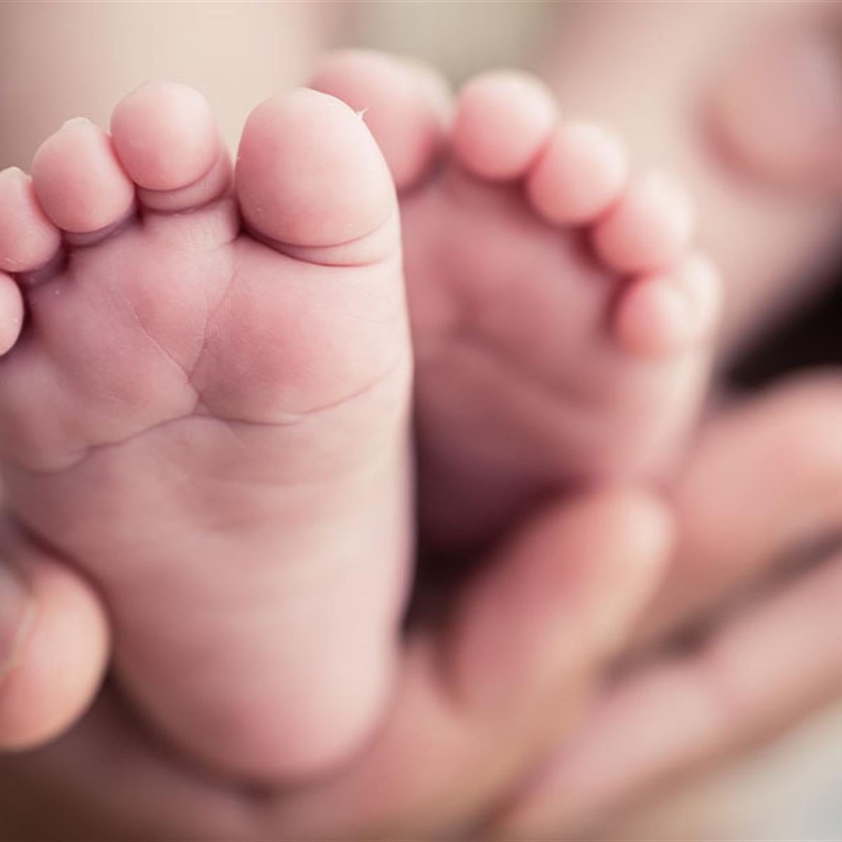 Newborn Feet Common Deformities
