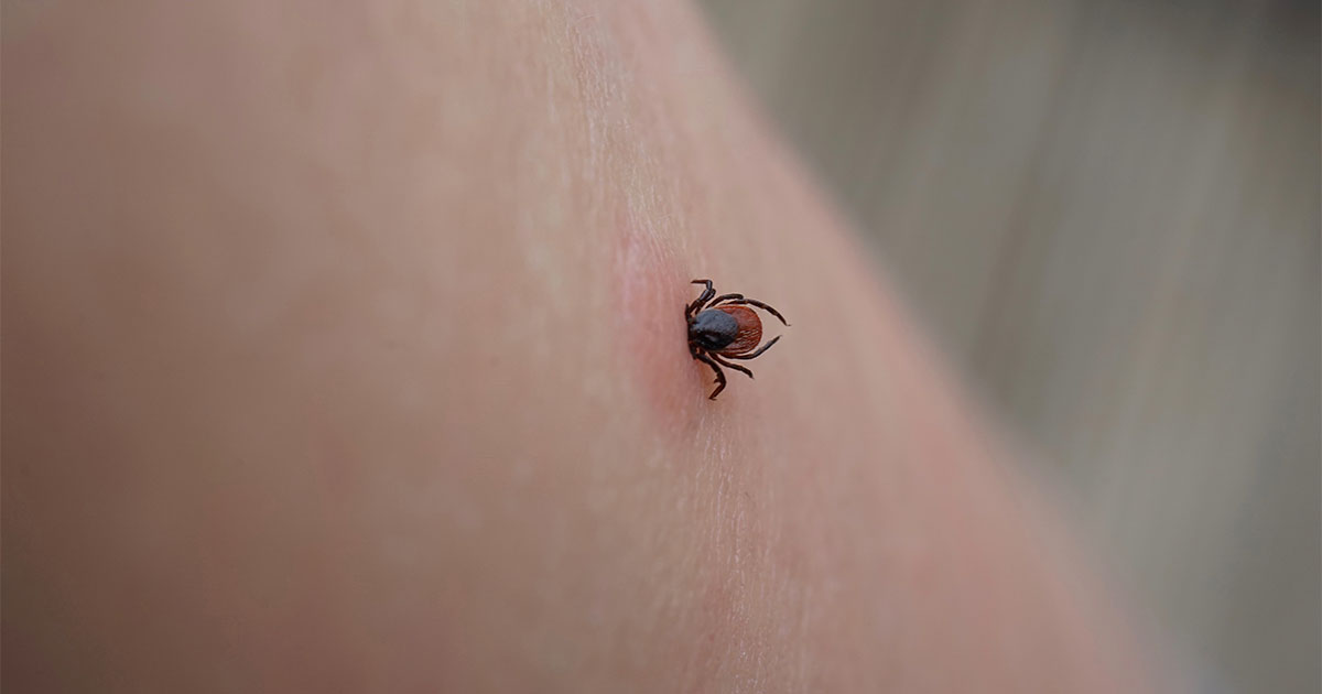 How To Remove A Tick HealthyChildren